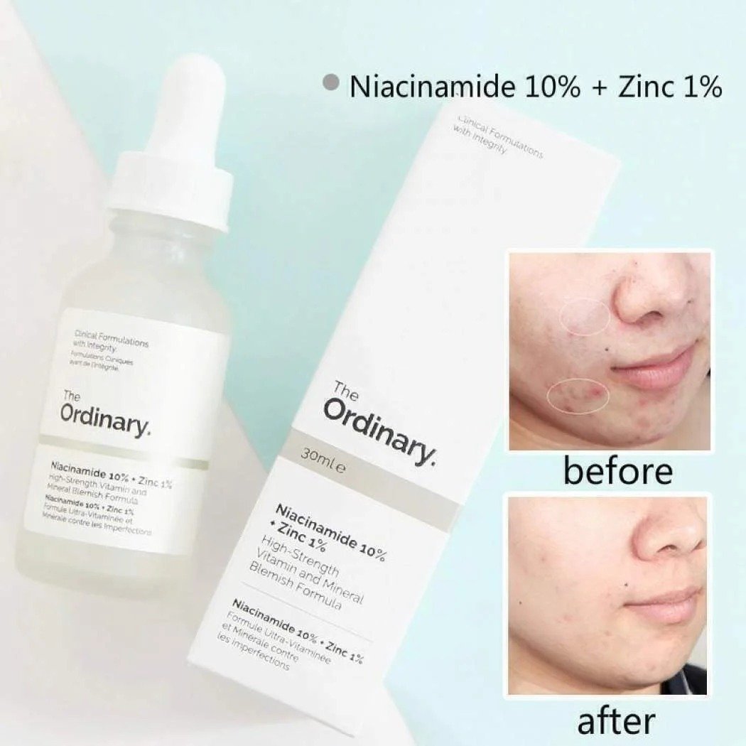 The Ordinary Niacinamide 10% + ZINC 1% 30ml (CANADA)